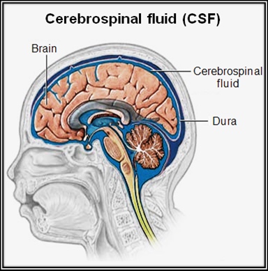 1-Image-Cerebrospinal fluid-Definition-Patient